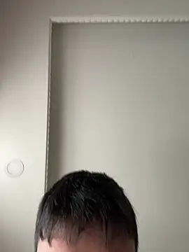 furkanktyAcalea online show from 01-10-26, 12:18